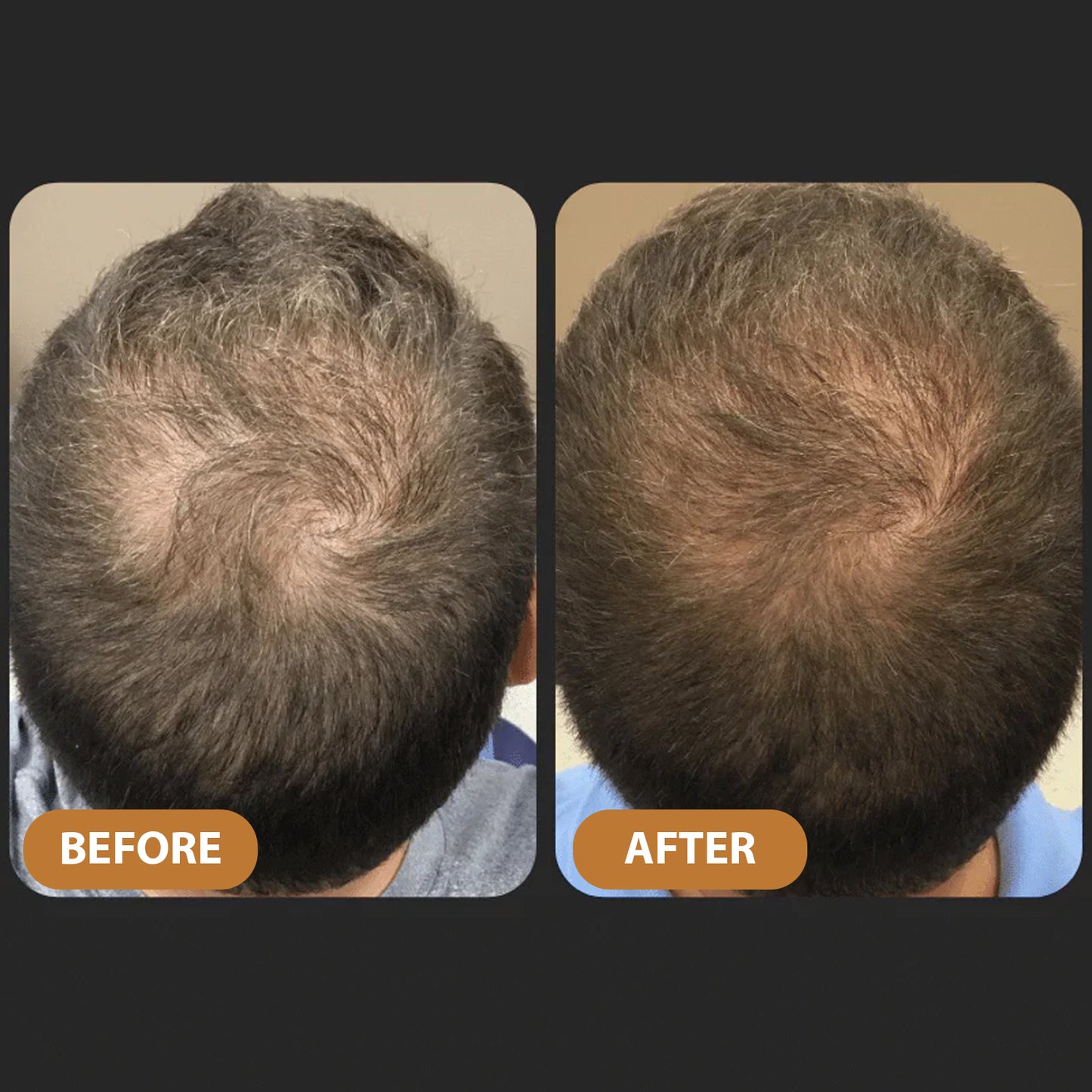 TITAN STRAND Ultimate Hair Growth Shampoo