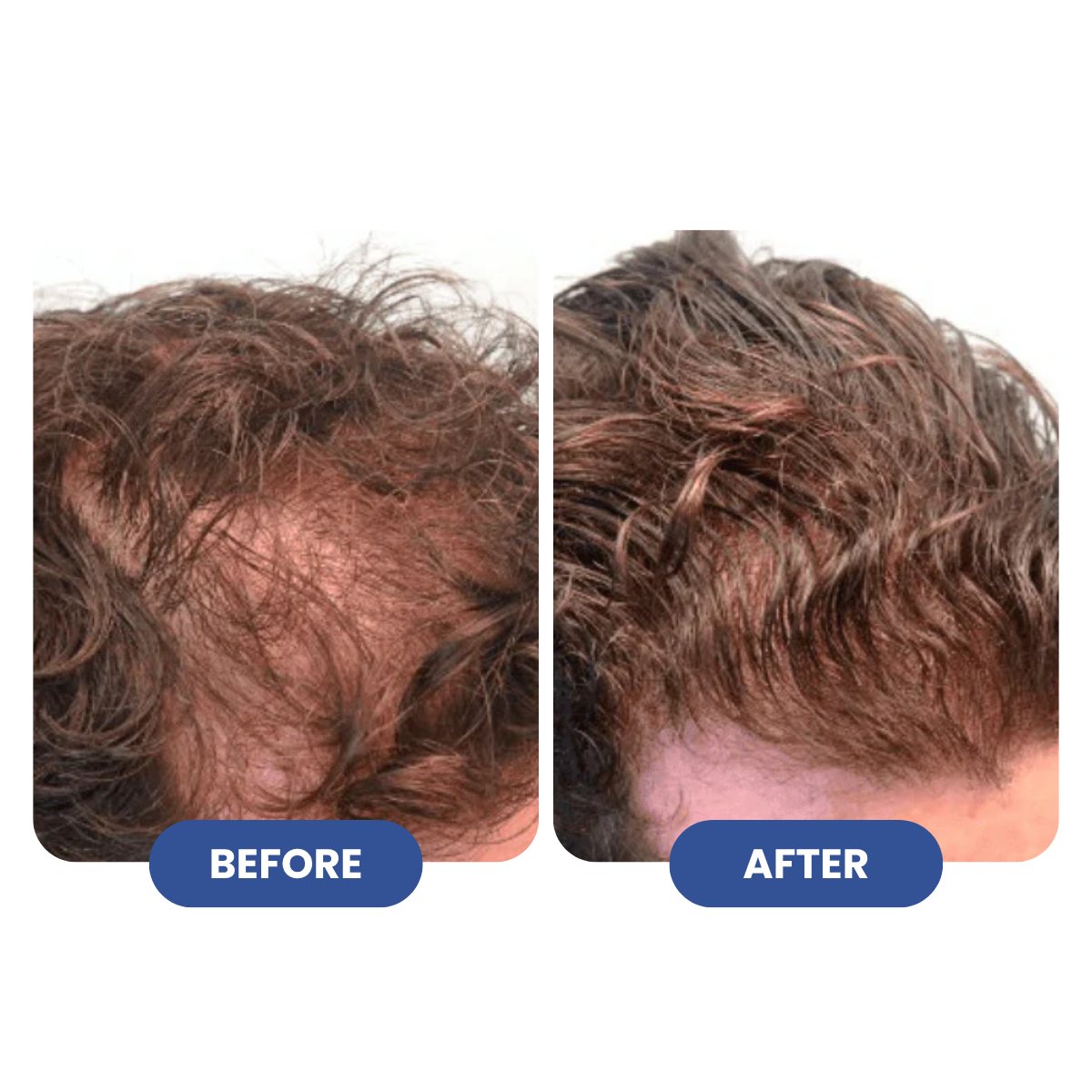 Titan Strand Ultimate Hair Growth Shampoo