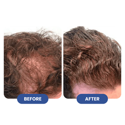 Titan Strand Ultimate Hair Growth Shampoo