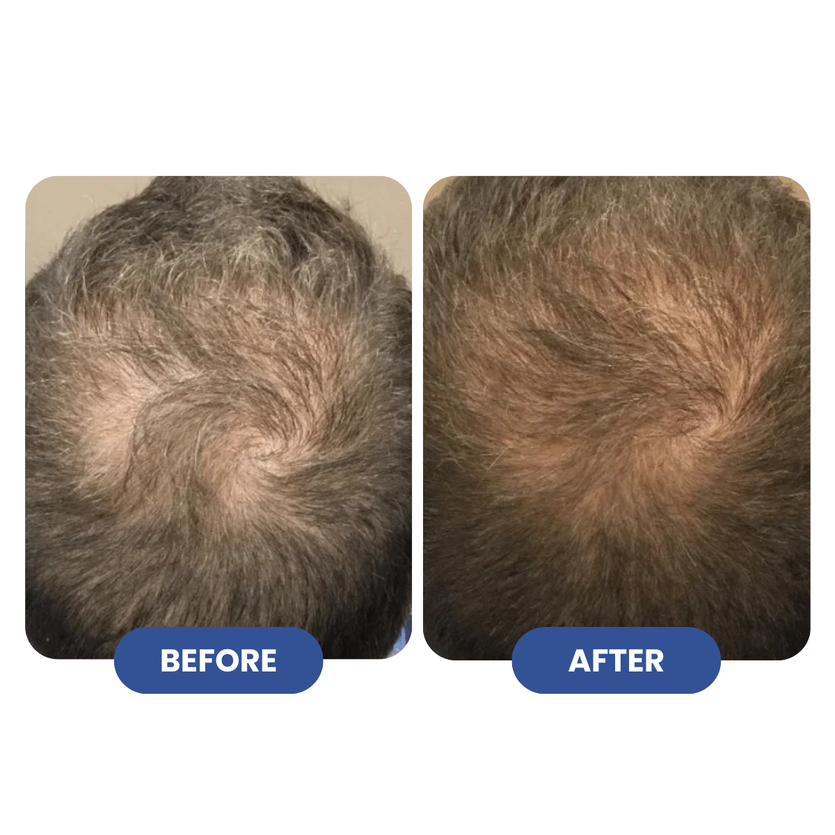 Titan Strand Ultimate Hair Growth Shampoo