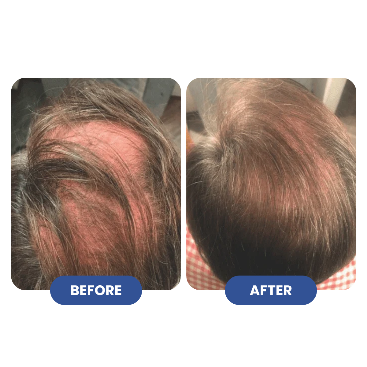 Titan Strand Ultimate Hair Growth Shampoo