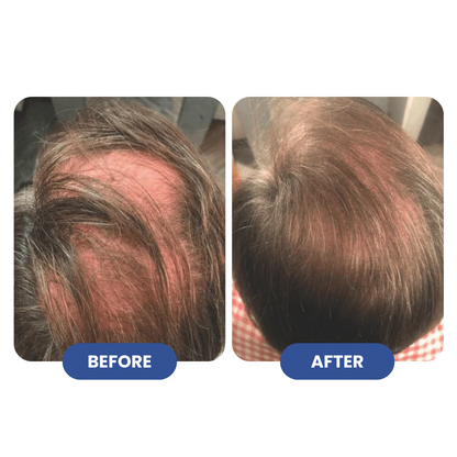 Titan Strand Ultimate Hair Growth Shampoo