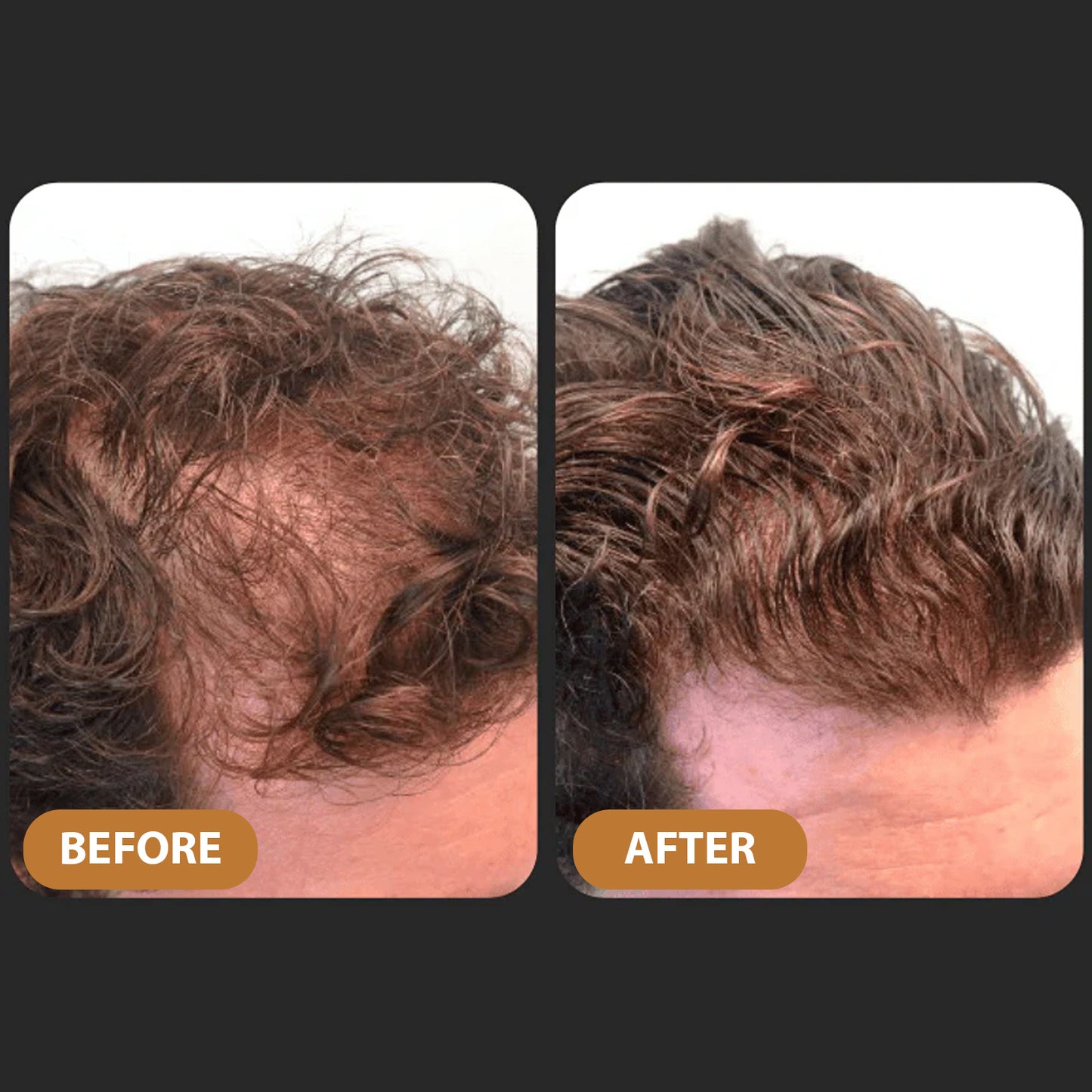 TITAN STRAND Ultimate Hair Growth Shampoo