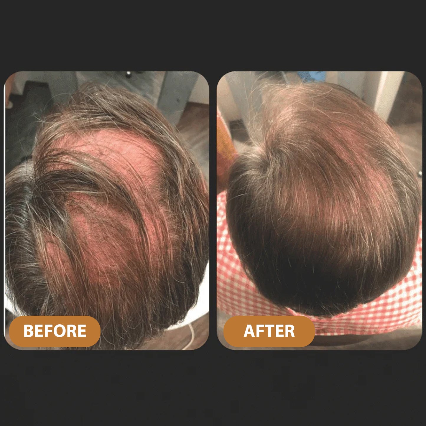 TITAN STRAND Ultimate Hair Growth Shampoo