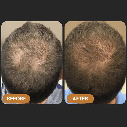 TITAN STRAND Ultimate Hair Growth Shampoo